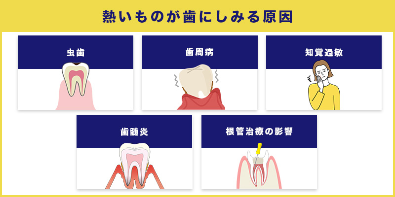 熱いものが歯にしみる原因