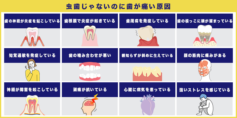 虫歯ではないのに歯が痛い原因