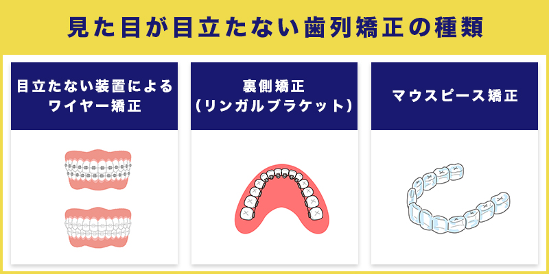 見た目が目立たない歯列矯正の種類